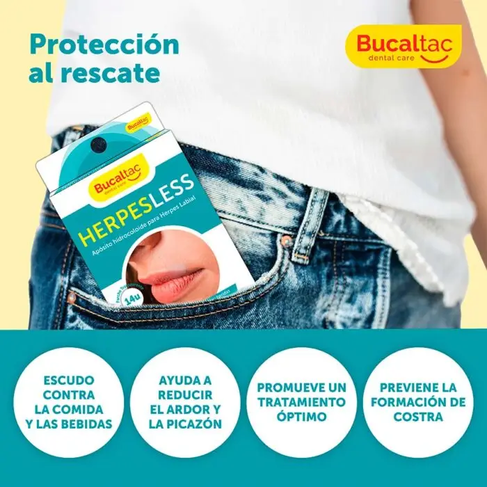BUCAL TAC HERPESLESS APOSITOS X14U