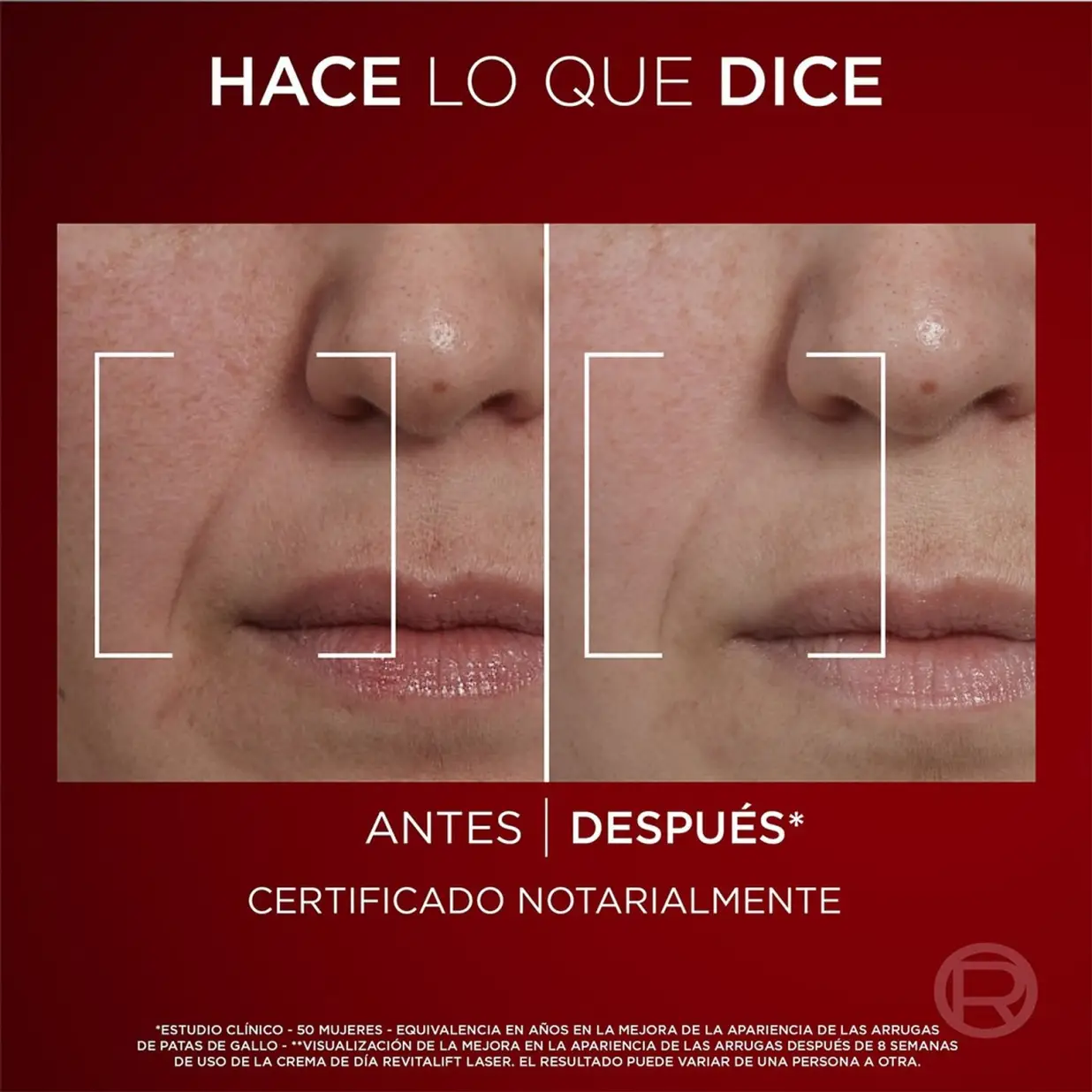 REVITALIFT LASER DIA X50 ML 